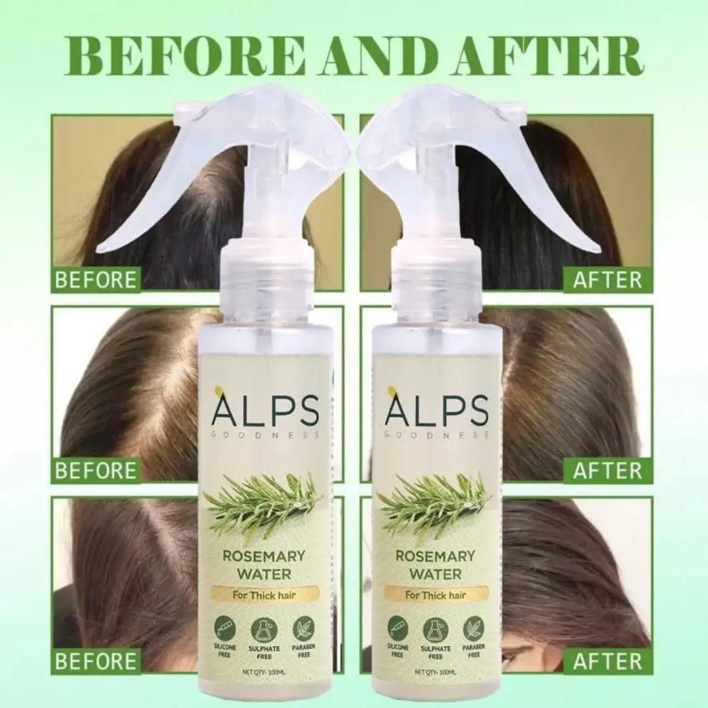 "Rosemary Water, Hair Spray For Regrowth Buy 1 Get 2 Free"