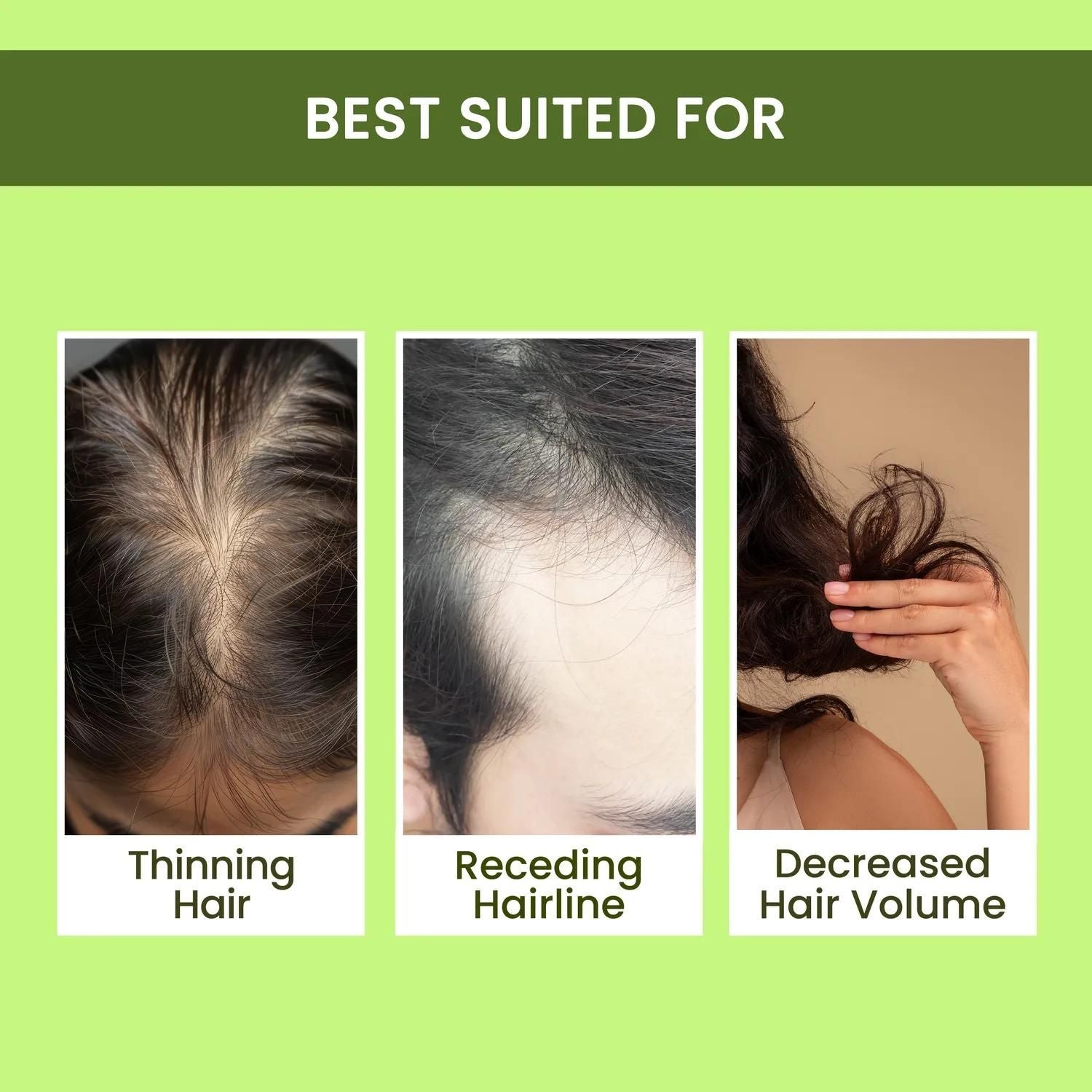 "Rosemary Water, Hair Spray For Regrowth Buy 1 Get 2 Free"